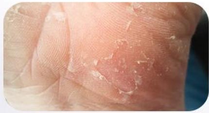 Skin moisturizing essential oil