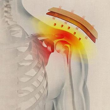 Traditional Chinese Medicine Acupoint Patches