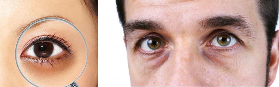 Dark Circle Reducing Essential Oil