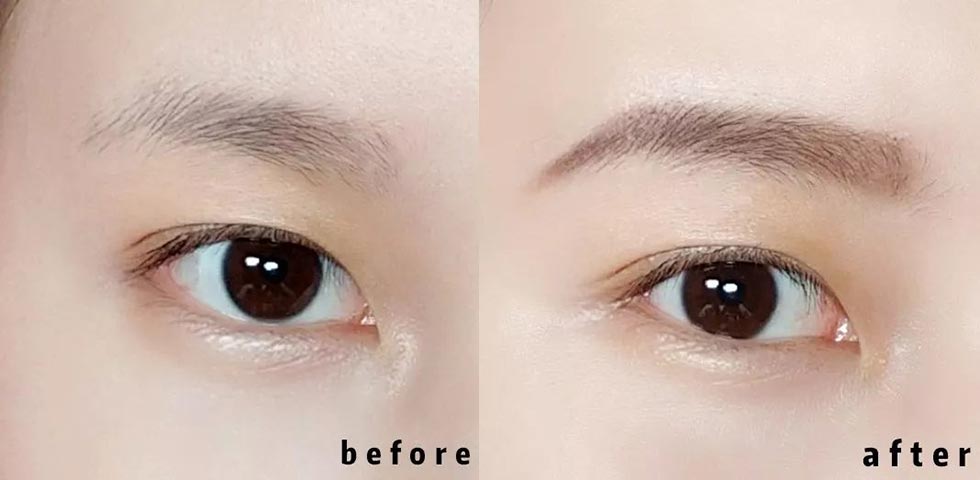 Natural Eye Bag Repair Essence
